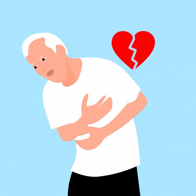 infarto